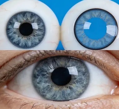 正目义眼技师正在为顾客定制义眼